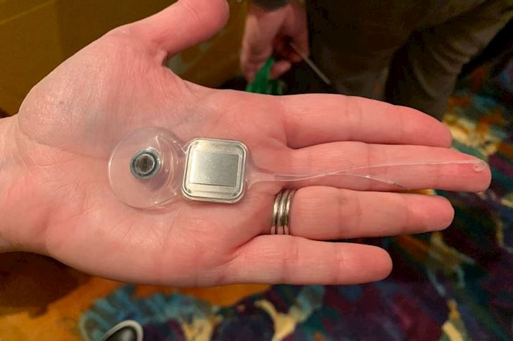 Độc đáo ốc tai điện tử điều khiển qua iPhone - cứu cánh cho người thính lực kém