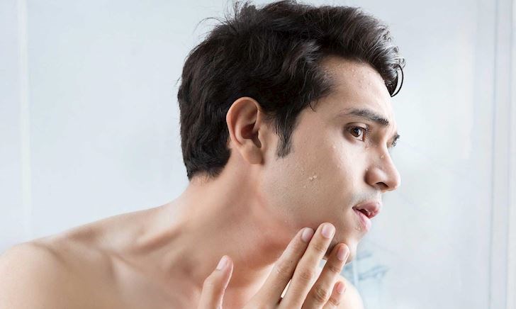 12 thói quen giúp giảm mụn và thu nhỏ lỗ chân lông dành cho da nhờn