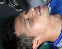 Video clip: Đình Trọng nén đau tập vật lý trị liệu