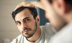 6 nhầm lẫn phổ biến về mái tóc đàn ông đang hiểu sai và sự thật