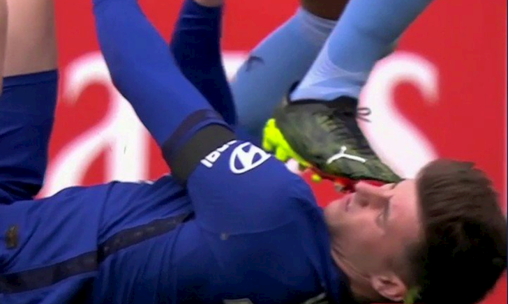 Cầu thủ Chelsea bị giẫm chân lên mặt gây phẫn nộ