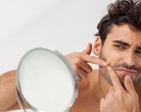 4 lý do khiến da lên mụn thường xuyên ở nam giới